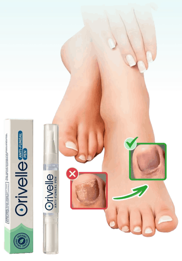 Orivelle Anti Fungal Pen official